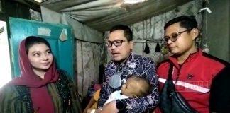 Balita di Brebes Alami Gizi Buruk, Paramitha Bantu Pengobatan