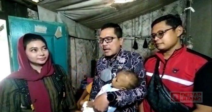 Balita di Brebes Alami Gizi Buruk, Paramitha Bantu Pengobatan