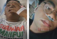 Selain Sesalkan Penganiayaan pada Relawan, TPD Ganjar-Mahfud Jateng Akan Kawal ke Proses Hukum